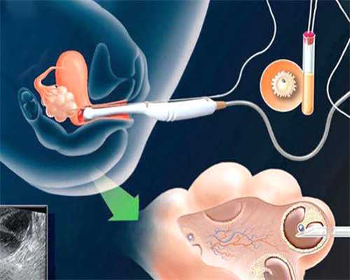 西安代孕中介,西安供卵医院需要等多久（私立医院供卵试管排行）