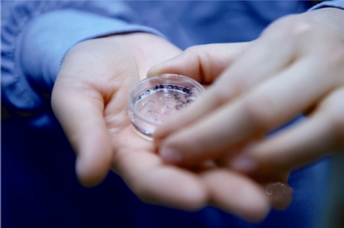 西安借卵包成功,宫腔粘连女性去美国做试管婴儿，选择什么方案比较好？_西安