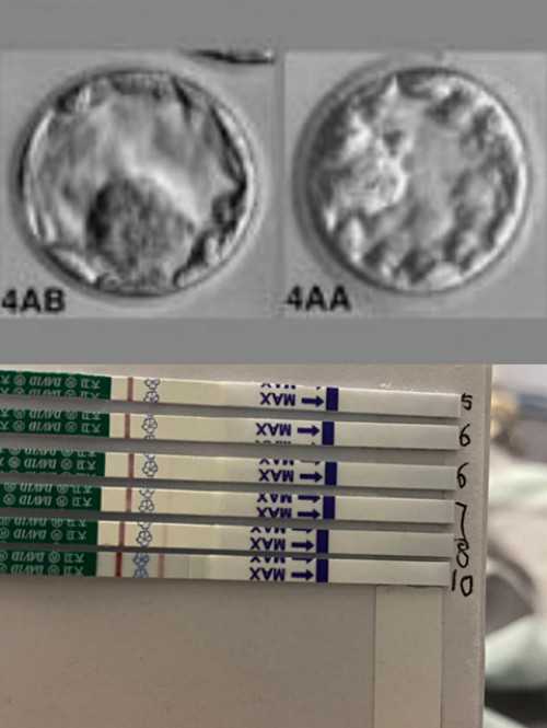 西安试管代生机构,西安妇幼医院试管婴儿花费_沈阳做三代试管婴儿要花多少钱