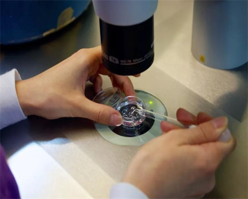 取卵过度刺激什么症状