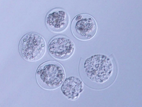 西安三代供卵公司,北京试管婴儿哪家做的好？如何监测排卵？-子宫肌腺症不打