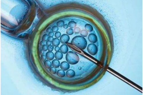 西安供卵公司名单,精子质量差影响做试管婴儿吗？(做试管前男性需要提前多久