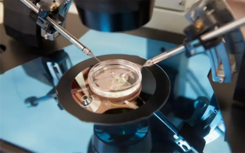 西安供卵龙凤胎,国外做试管婴儿多少钱？会很贵吗？-西安供卵试管费用_试管移