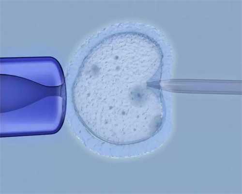西安哪个供卵好,美国试管婴儿移植前饮食注意事项_西安试管供卵公司-7749算生