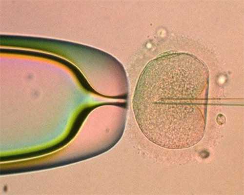 有卵泡不排卵 不排卵的原因有哪些~助孕包生男孩