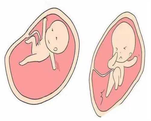 西安专业代怀收费,艰难备孕5年，三代试管婴儿终好孕-西安能做供卵吗-试管移
