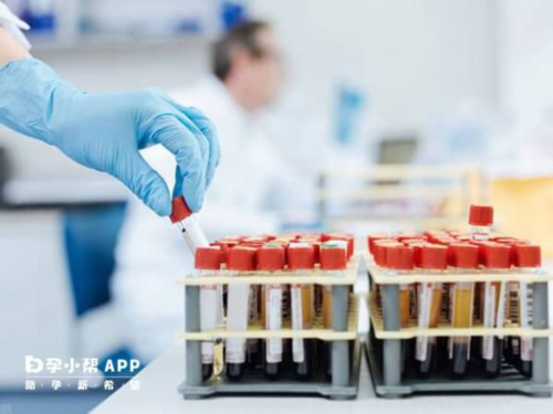 西安正规代孕哪家好,西安西京医院看nu卵巢早衰咋样