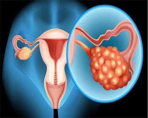 西安专业代孕机构,高龄做第三代试管婴儿行不行？为什么三代要去国外做_试管