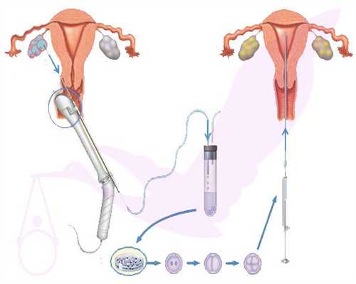 西安代怀公司喜孕来,【你必须知道】西安私立医院可以做三代试管婴儿吗
